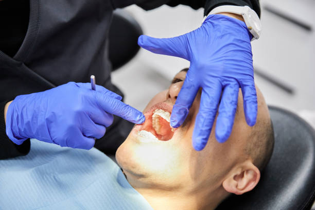 Best Teeth Whitening  in Fairwood, WA